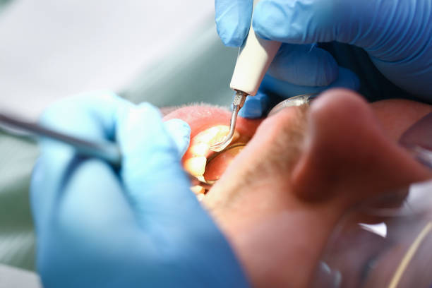 Best Walk-In Emergency Dentist in North Springfield, VA