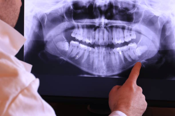 Best Emergency Tooth Extraction in North Springfield, VA