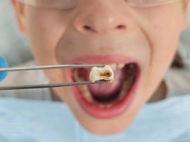 Best Same-Day Emergency Dentist in North Springfield, VA