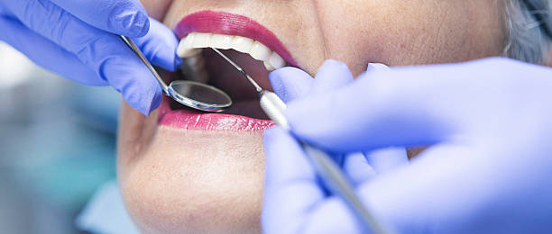 Best Emergency Broken Tooth Repair in North Springfield, VA
