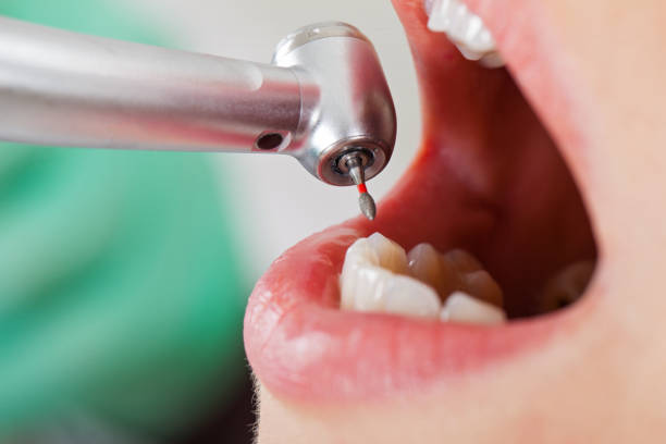 Best Emergency Dental Surgery in North Springfield, VA